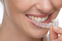 Как сделать зубы белоснежными
