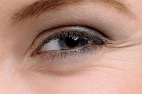 Что поможет против морщин вокруг глаз